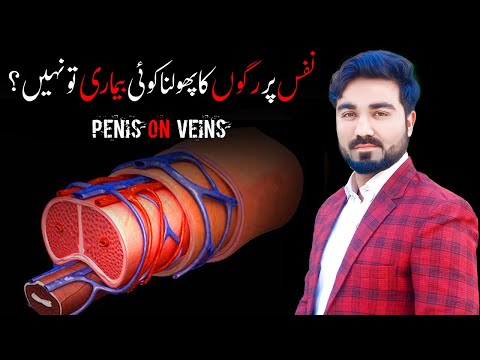 Veins on penis | Nafs Ki Ragon Ka Ubhar Jana