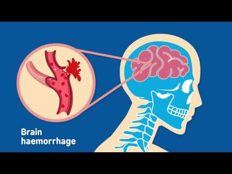 What is a head injury?