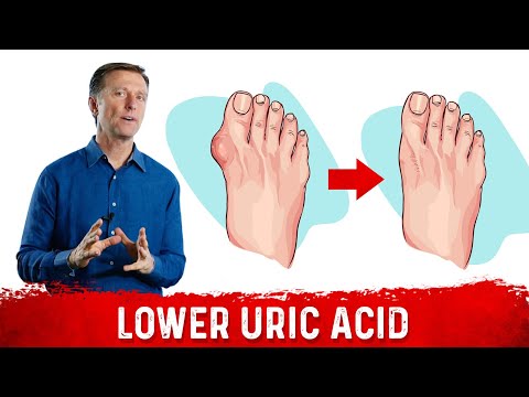 4 Ways  to Neutralize Uric Acid