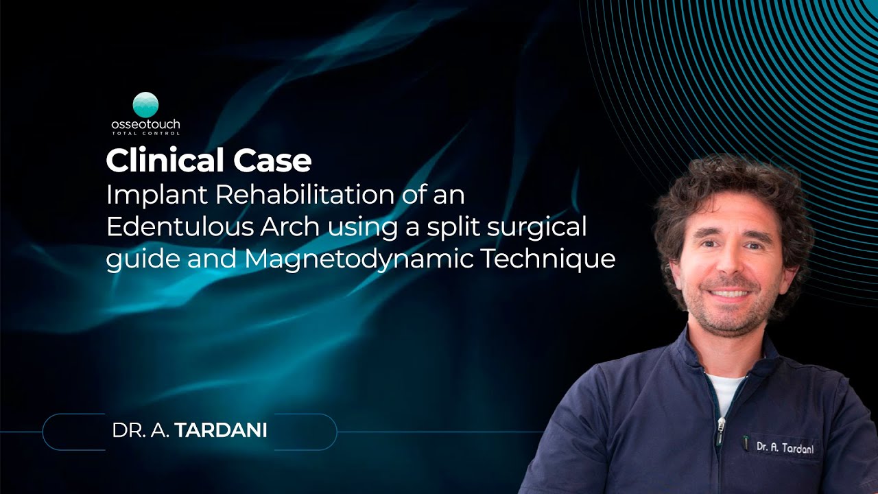 Guided Surgery with Magnetic Mallet — clinical case demonstration