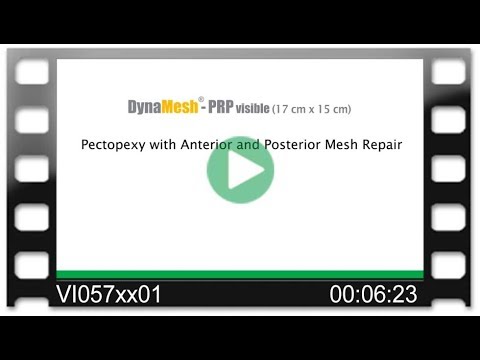 DynaMesh®-PRP visible 17 cm x 15 cm - OR-Video: Pectopexy with Anterior and Posterior Mesh Repair