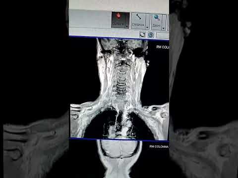 ABUSO DI POTERE Quando diventi scomodo, tutti si girano con arroganza da un'altra parte.(2)