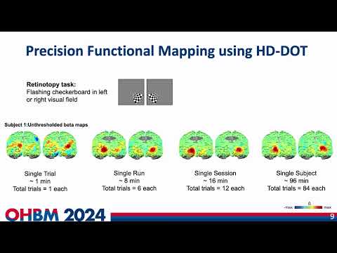 OHBM 2024 | Oral Session | Aahana Bajracharya |  Developing Methods for Precision High-Density Dif…