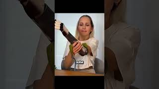 Download lagu This Woman Had A Prosthetic Arm mp3 Download lagu This Woman Had A Prosthetic Arm mp3