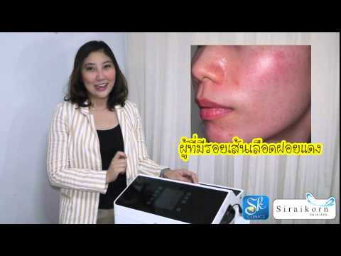 โรคผิวหนังภูมิแพ้ 7 เดือน โรคสะเก็ดเงิน Palmar-ฝ่าเท้าแบบฟอร์ม การรักษา