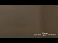 Journey Inside Woman S Belly Button 17