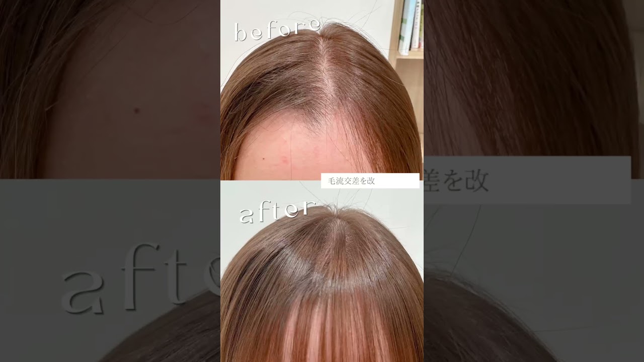 前髪の生えぐせ改善TOKIKATA#shorts#TOKIKATA#トキカタ