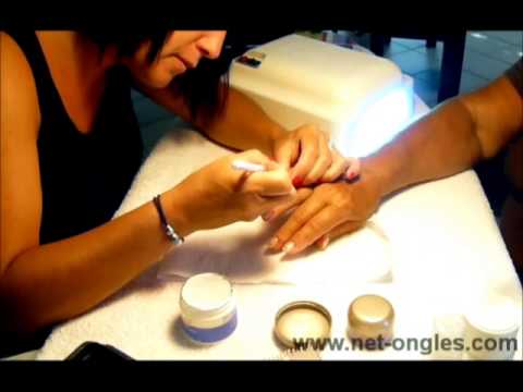 comment poser gel ibd