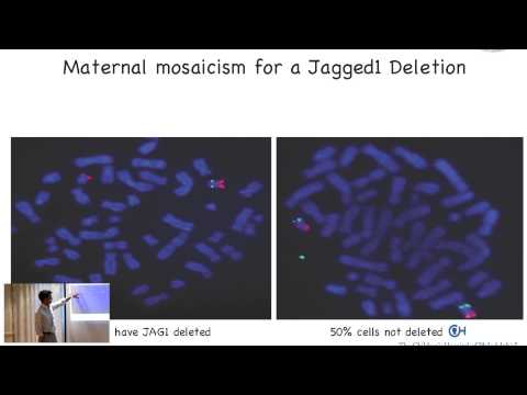 Genetics of ALGS - 2014 - Dr. Lin - Sat - 04_30pm - Breakout