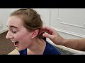 INTENSE EAR TREATMENT CRUNCHES TINGLES Pops And Relaxation Mondragon DC Florida