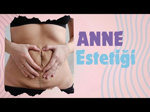 Anne Estetiği