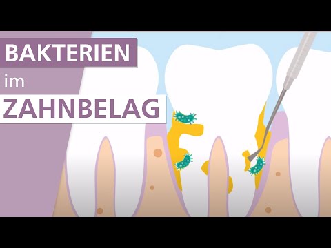 Behandlung von Parodontitis