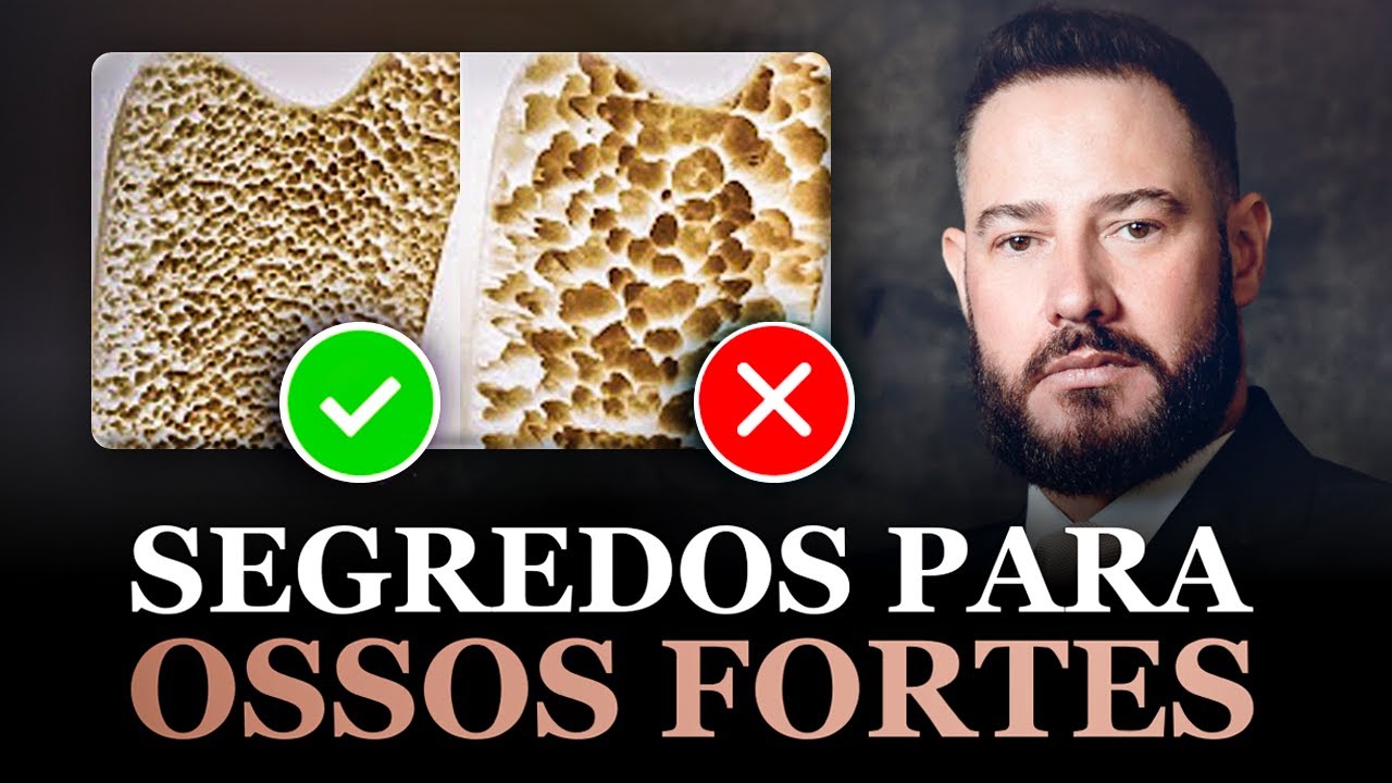OSTEOPOROSE: Como FORTALECER seus OSSOS e Evitar um Futuro Perigoso!