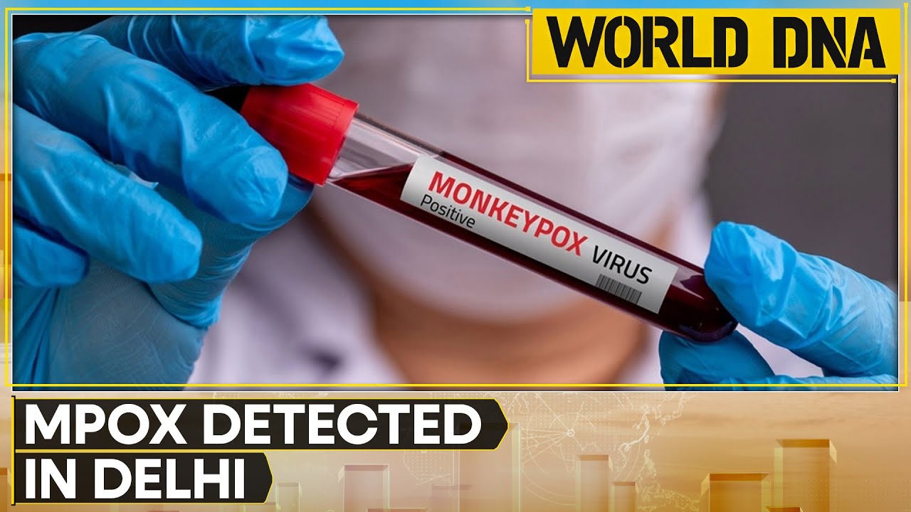 India reports first suspected case of Mpox | Latest English News | WION World DNA