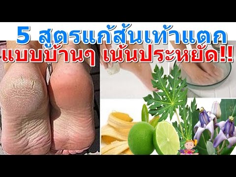 แคปซูลทิเบตโรคสะเก็ดเงิน ครีมสำหรับซื้อตัวชี้นำโรคสะเก็ดเงิน