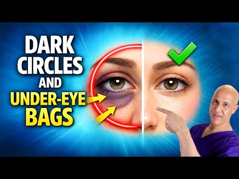 Dark Circles and Under-Eye Bags — This Actually Works | Dr. Mandell