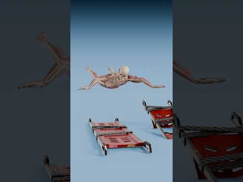 One Broken Bone vs 64 Broken Bones