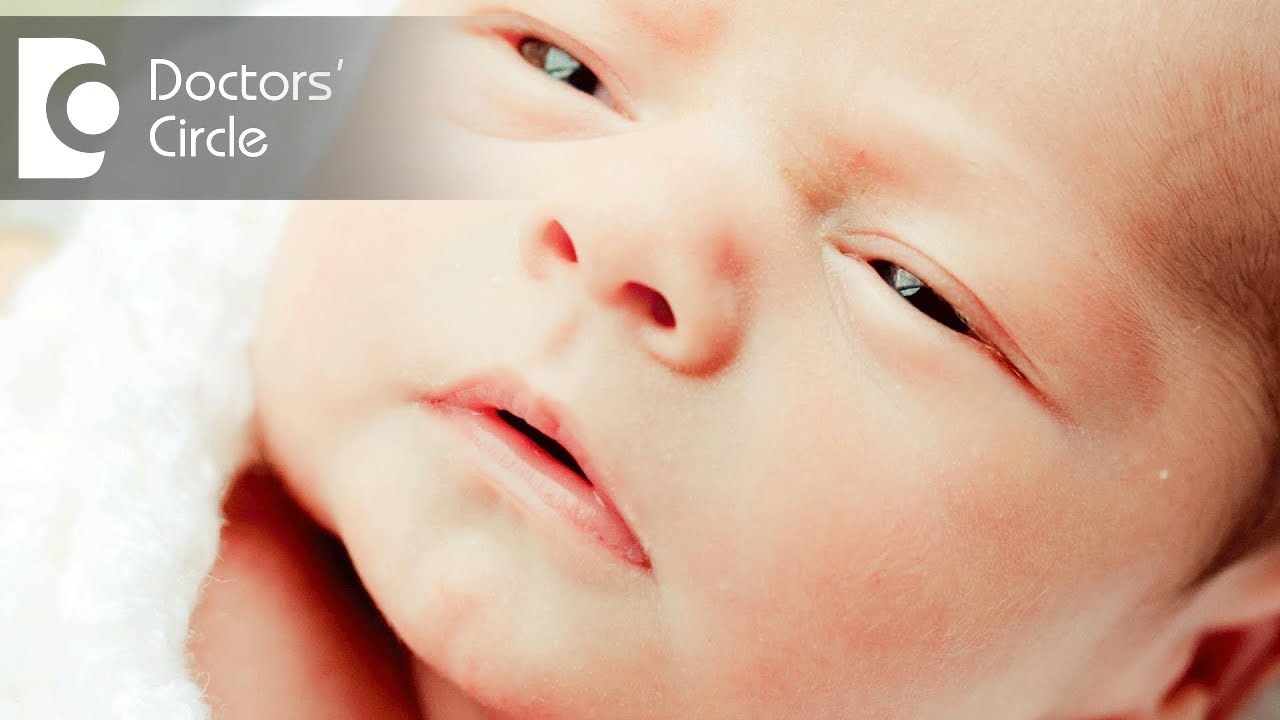 How common are cases of Neonatal Jaundice?-Dr.R.Kishore Kumar of Cloudnine Hospitals|Doctors' Circle