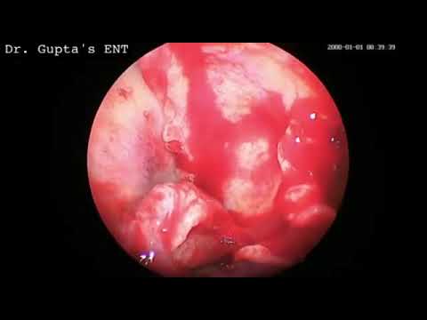 Hd Endoscopy Camera With Recording