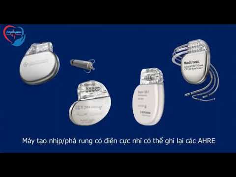 Tầm soát rung nhĩ và xử trí rung nhĩ dưới lâm sàng