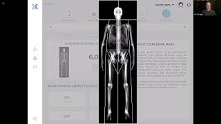 How to understand your DEXA Report