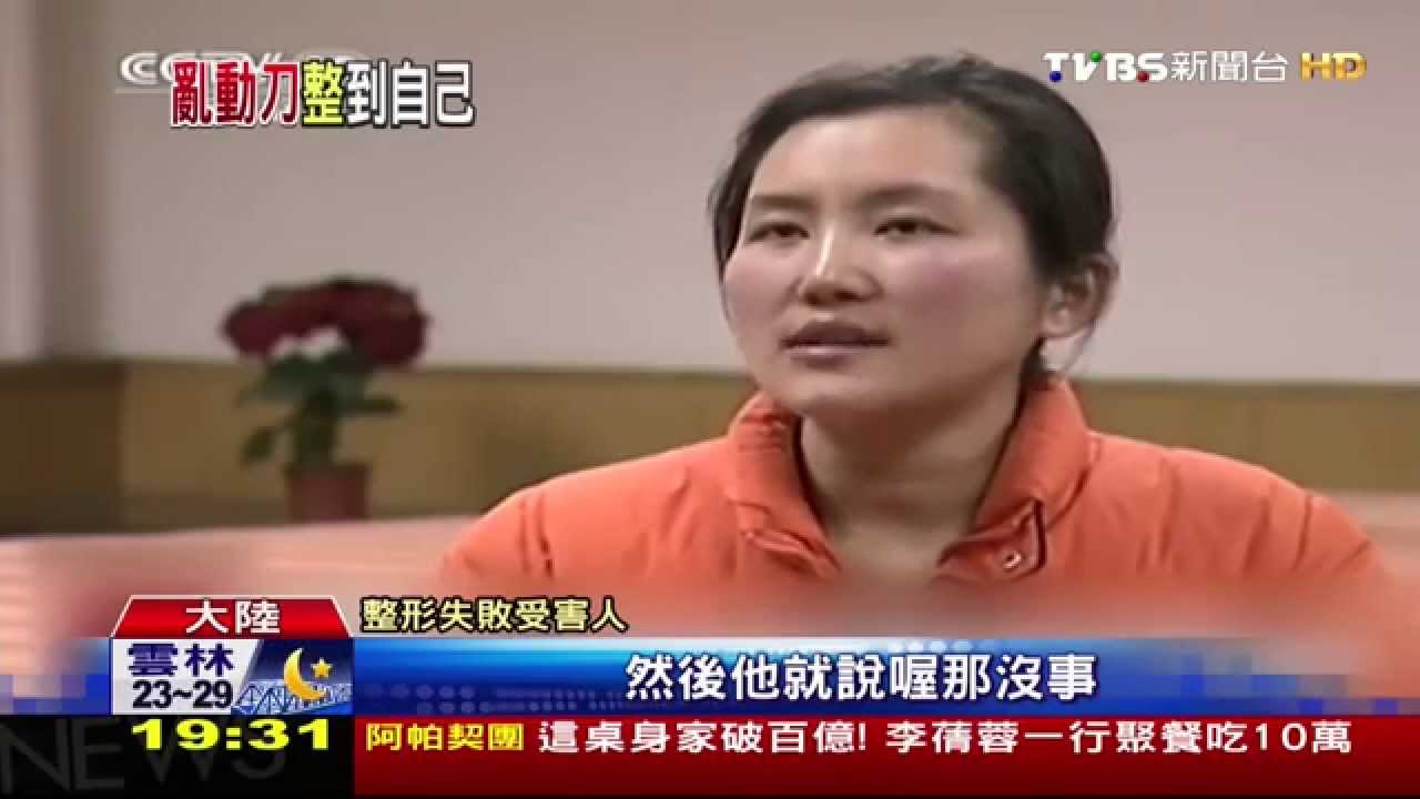 一口氣動17刀!陸女赴韓整形 鼻歪嘴斜