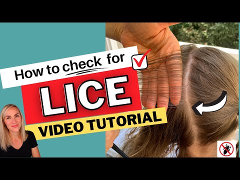How to Check for Lice Video Tutorial