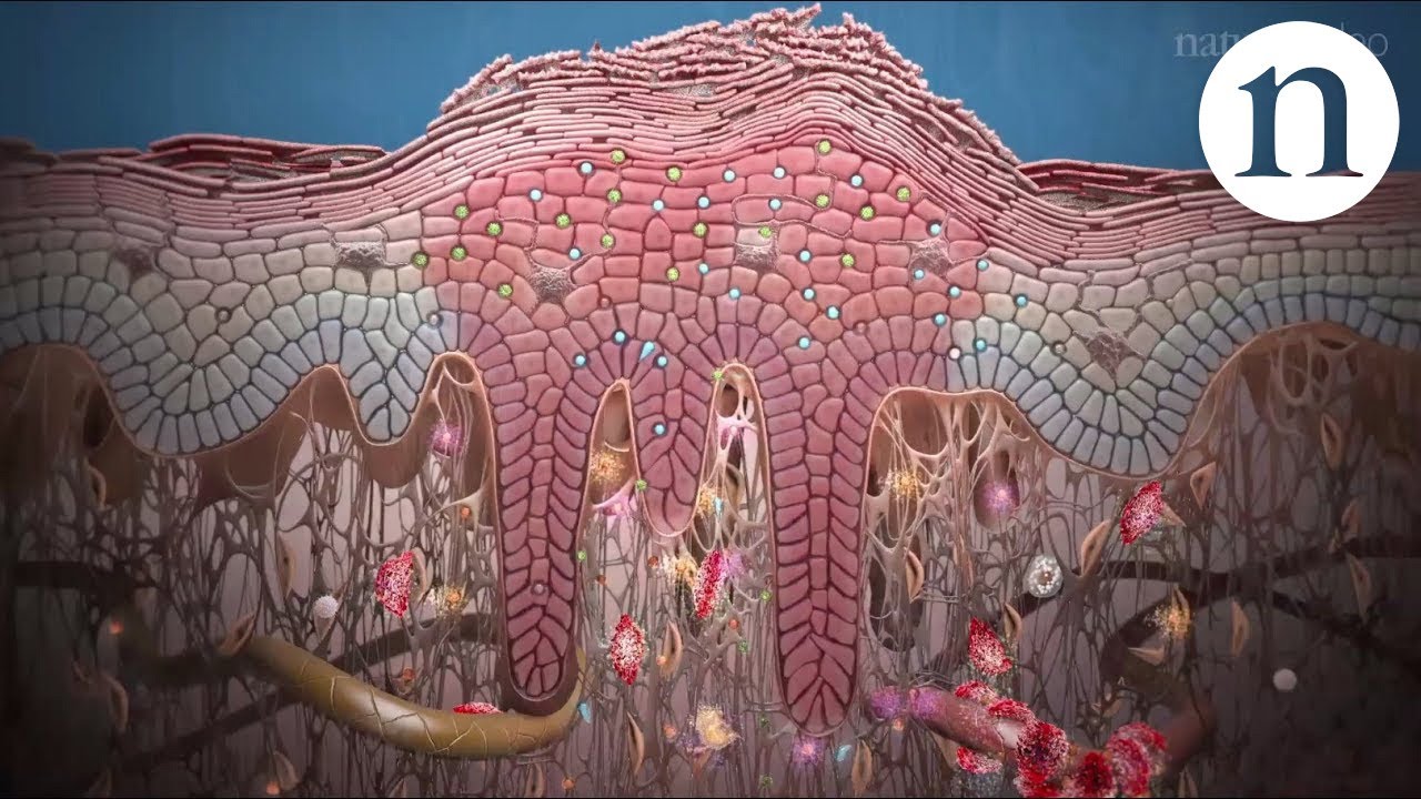 Psoriasis and beyond: targeting the IL-17 pathway