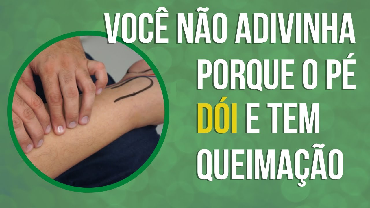 😕 Você não adivinha porque o pé DÓI e tem queimação