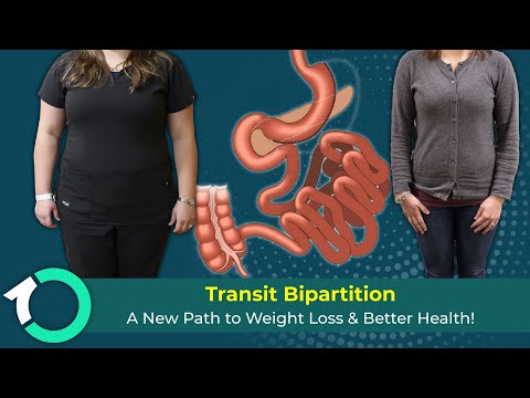Laparoscopic Transit Bipartition Metabolic Surgery - Surgical Procedure - One Clinic Patient Review Video