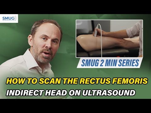 How to Scan the Rectus Femoris Indirect Head on Ultrasound | MSK Ultrasound Training (UK)