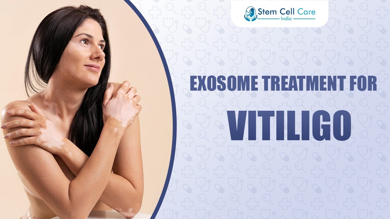 Future of Vitiligo Treatment? Understanding Exosome Therapy | Benefits, and Treatment Outcomes