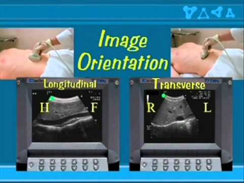 Ultrasonografia - fizyka i budowa aparatu