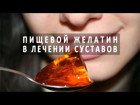 От остеохондроза что пить какие таблетки Что такое водянка суставов