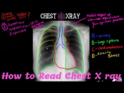 What is a C Arm Machine and How to work Working principle of C Arm Uses