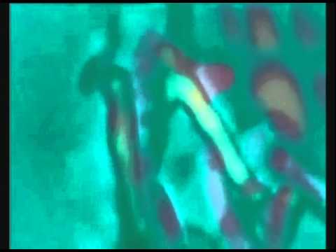 Robyn vs Scissor Sisters DJ JD Salinger Mashup