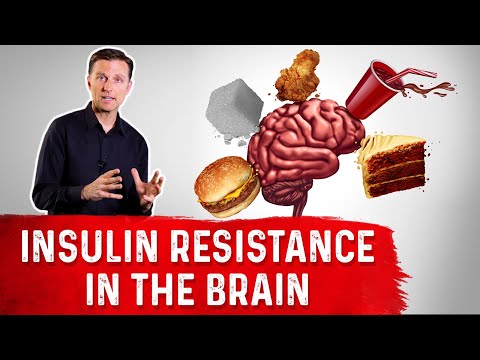 Adrenal Fatigue Is Cortisol Responsible for Your Diabetes Dr Berg