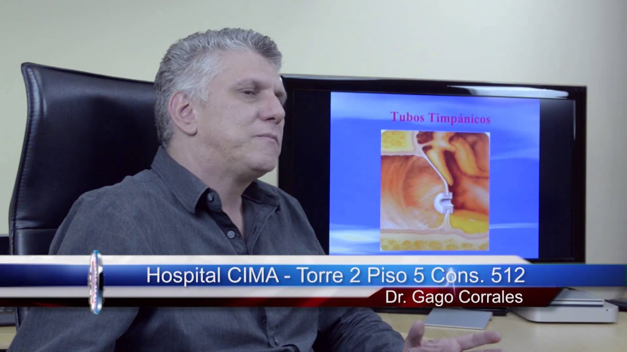 Tratamiento de la Otitis Media Sero-Mucosa (moco en oído medio)