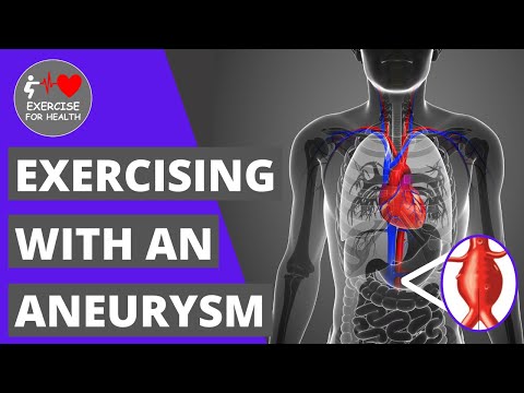 How safe is it to exercise with an Aneurysm?