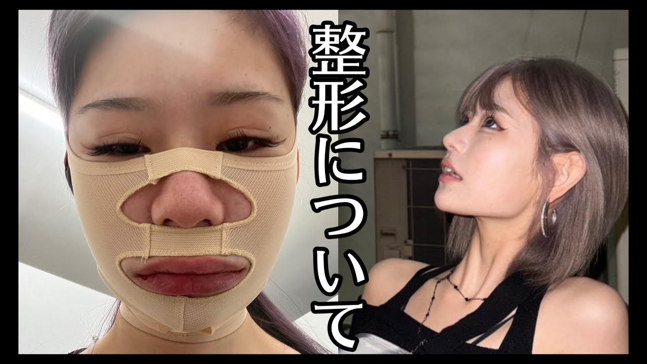 整形について全て話します。