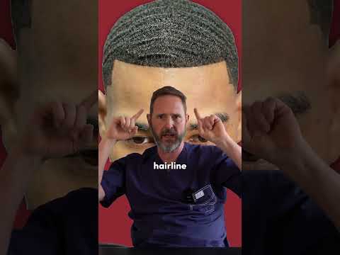 Mastering the Natural Hairline Design for Your Hair Transplant Procedure in Istanbul, Turkey