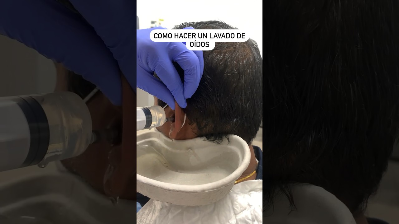 LAVADO DE OIDO, TAPÓN DE CERA 🕯️ #shorts