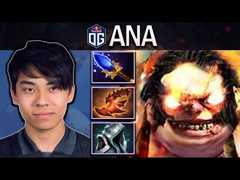OG.ANA SMURF PUDGE WITH 20 KILLS & OVERWHELMING BLINK - DOTA 2 7.31 GAMEPLAY