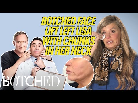 Lisa's Pelican Neck BOTCHED By Surgeon During Facelift Procedure (Before & After) | Botched | E!