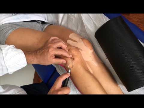Gel per giunti 911 buy Sottile capsula articolare