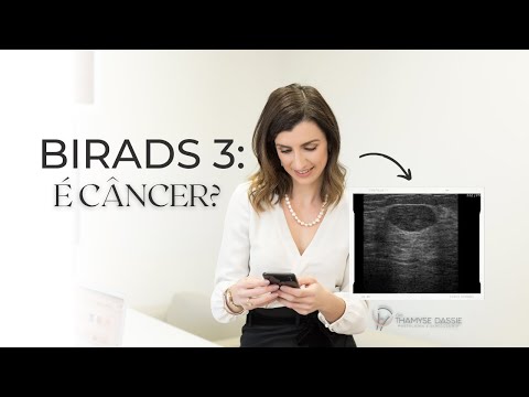 Nódulo BIRADS 3 - o que devo fazer?