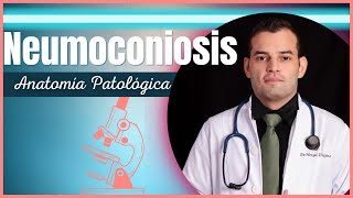 Anatomía Patológica - Neumoconiosis