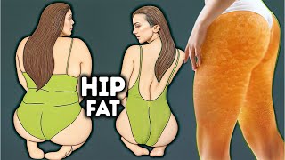 LOSE HIP FAT & CELLULITE | SIMPLE EXERCISES THAT EVERYONE CAN DO