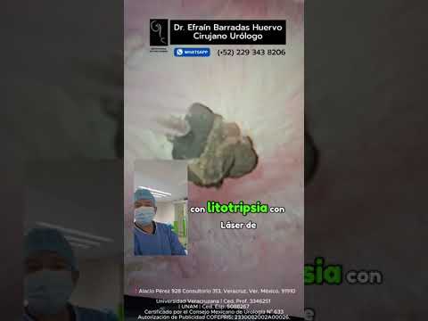 Efrain Barradas Huervo-42