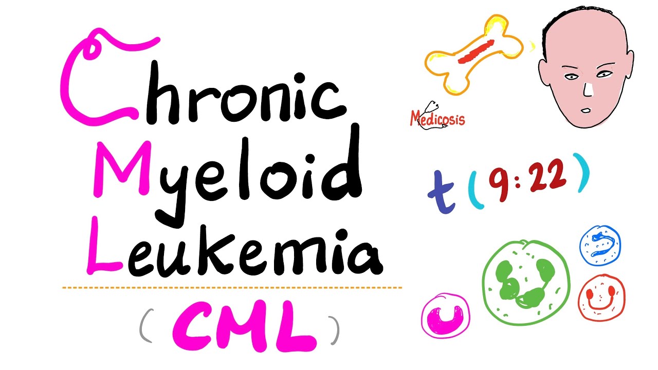 Chronic Myeloid Leukemia (CML) - Myeloproliferative Neoplasm (MPN) - Philadelphia Chromosome